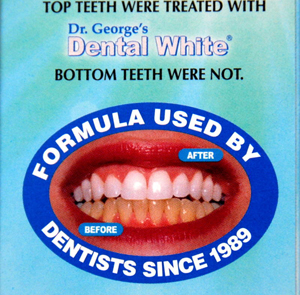 Dental White before after