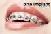 Intretinere/Infrumusetare Orto Implant