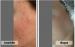 Intretinere/Infrumusetare Anna Skin Care